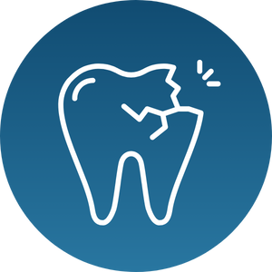 Bruxism - Damaged Teeth